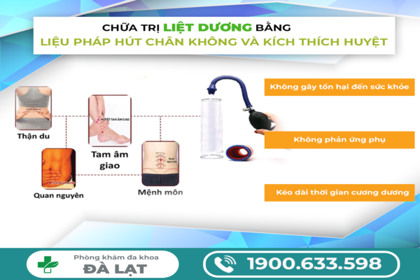 Hình ảnh minh họa